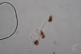 Attēlu rezultāti vaicājumam “Physarum alexandrowiczii spores”