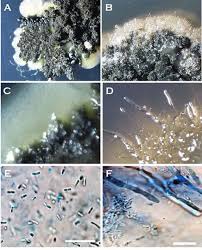Attēlu rezultāti vaicājumam “Dianema nivale spores”