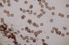 Attēlu rezultāti vaicājumam “Physarum album”