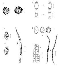 Attēlu rezultāti vaicājumam “Craterium leucocephalum var. scyphoides spores”