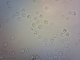 Attēlu rezultāti vaicājumam “Basidiodendron”