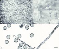 Attēlu rezultāti vaicājumam “Metatrichia vesparia”