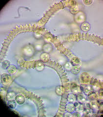 Attēlu rezultāti vaicājumam “Arcyria, Heterotrichia sp.”