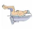 Lithotomy position - Wikipedia, the free encyclopedia