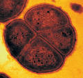Top 10 Extreme Forms of Life | Top 10 Lists | TopTenz.