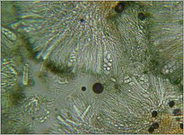 Attēlu rezultāti vaicājumam “Lecidella elaeochroma”