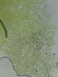 Attēlu rezultāti vaicājumam “Chaenotheca gracilenta”