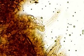 Attēlu rezultāti vaicājumam “Lycogala asperum macro”