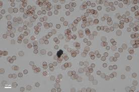 Attēlu rezultāti vaicājumam “Comatricha elegans var. microspora spores”