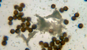 Attēlu rezultāti vaicājumam “Badhamia lilacina plasmodium”