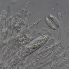 Attēlu rezultāti vaicājumam “Hyaloscypha hyalina”