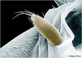 Attēlu rezultāti vaicājumam “Leucochloridium paradoxum larva”
