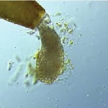 Attēlu rezultāti vaicājumam “Bryum pallens sporophyte”