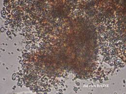 Attēlu rezultāti vaicājumam “Stictis”