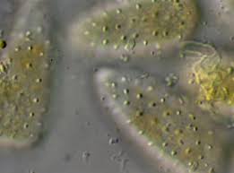 Attēlu rezultāti vaicājumam “Melampsoridium sp.”