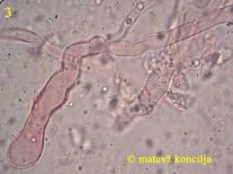 Attēlu rezultāti vaicājumam “Vuilleminia comedens”