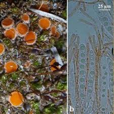 Attēlu rezultāti vaicājumam “Heterotrichia pomiformis (syn. Arcyria pomiformis) spores”