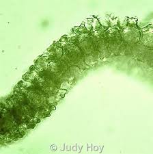 Attēlu rezultāti vaicājumam “Heterotrichia oerstedii (syn. Arcyria oerstedii) young”
