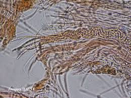 Attēlu rezultāti vaicājumam “Stictis”