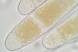 Attēlu rezultāti vaicājumam “Bactridium flavum”