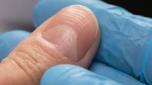 Image result for lunula nail