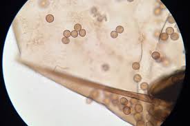 Attēlu rezultāti vaicājumam “Collaria arcyrionema spores”