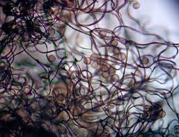 Attēlu rezultāti vaicājumam “Comatricha alta”