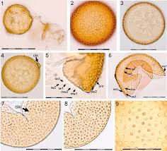 Attēlu rezultāti vaicājumam “Trichia alpina spores”