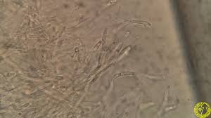 Attēlu rezultāti vaicājumam “Calocera glossoides”