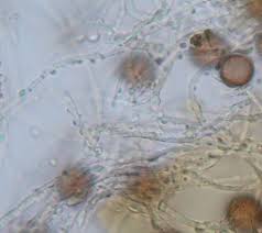 Attēlu rezultāti vaicājumam “Perichaena depressa spores”
