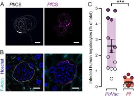 Attēlu rezultāti vaicājumam “Siphoptychium violaceum plasmodium”