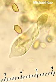 Attēlu rezultāti vaicājumam “Blepharostoma trichophyllum sporophyte”