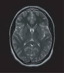 Image result for no brain