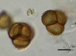 Attēlu rezultāti vaicājumam “Cribraria oregana spores”