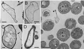 Attēlu rezultāti vaicājumam “Trichia alpina young”