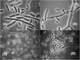 Attēlu rezultāti vaicājumam “Enteridium variabile spores”