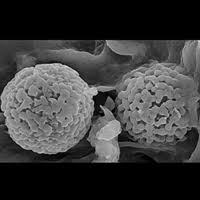 Attēlu rezultāti vaicājumam “Pachyphloeus melanoxanthus”