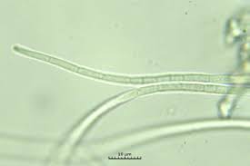 Attēlu rezultāti vaicājumam “Stictis”