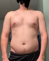 Image result for manboobs