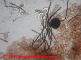 Attēlu rezultāti vaicājumam “Badhamiopsis macrospora spores”