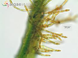 Attēlu rezultāti vaicājumam “Trentepohlia sp.”