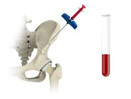 Image result for BMAC