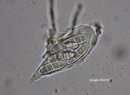 Attēlu rezultāti vaicājumam “Plectocarpon lichenum”