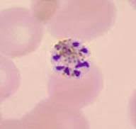 Attēlu rezultāti vaicājumam “Diderma radiatum plasmodium”