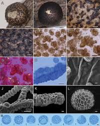 Attēlu rezultāti vaicājumam “Lycogala botrydium spores”