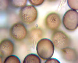 Attēlu rezultāti vaicājumam “Lamproderma arcyrioides macro”