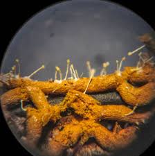 Attēlu rezultāti vaicājumam “Diachea dictyospora (syn. Craterium dictyosporum) spores”