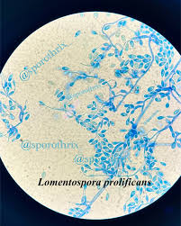 Attēlu rezultāti vaicājumam “Orthotrichum cupulatum var. riparium sporophyte”
