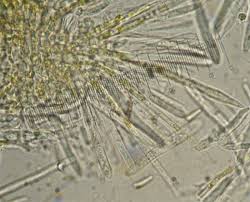 Attēlu rezultāti vaicājumam “Lachnum virgineum”