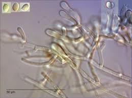 Attēlu rezultāti vaicājumam “Athelia arachnoidea”